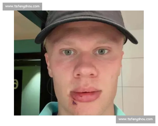 哈兰德警示挪威同胞:迈阿密烈日下的防晒必修课